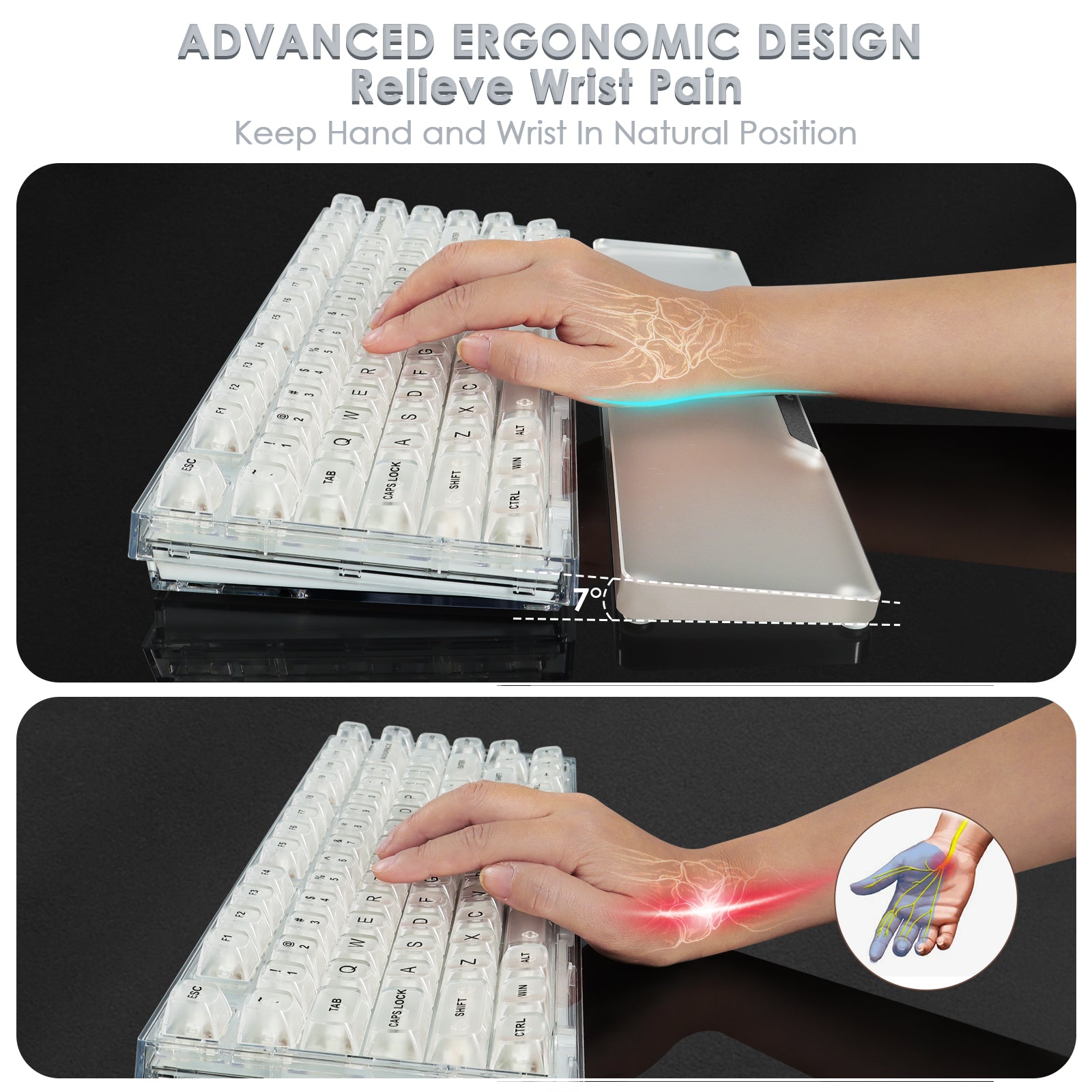 Hand resting on translucent keyboard wrist rest showing ergonomic design.